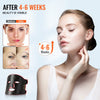 VEVOR Red Light Therapy for Face, Red Light Therapy Mask with 3 Wavelengths and 3 Intensity Levels, LED Face Mask Light Therapy, Portable Facial Skin Care Device for Skin Health, Anti Aging Wrinkles